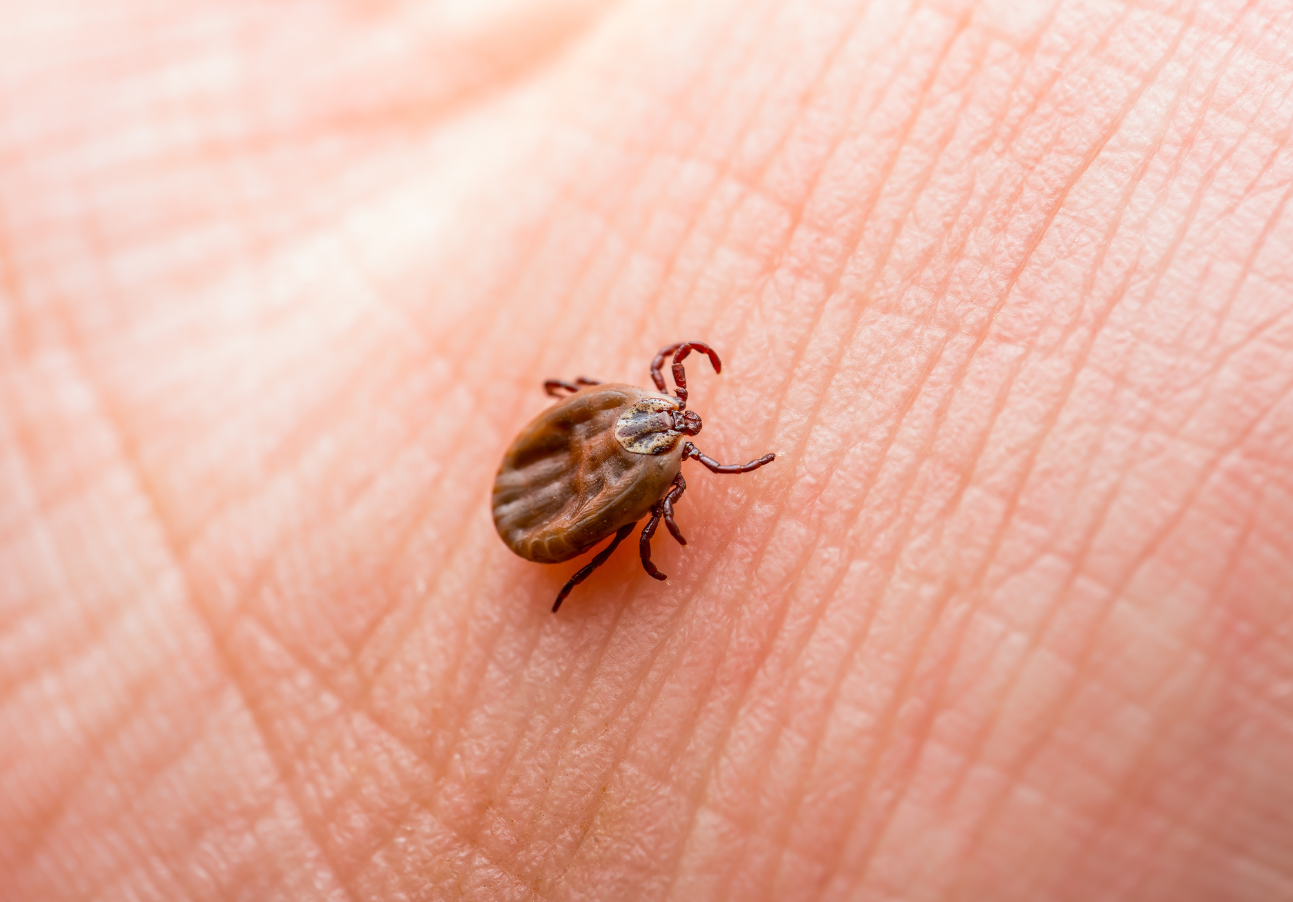 Closeup of a tick on a person's skin